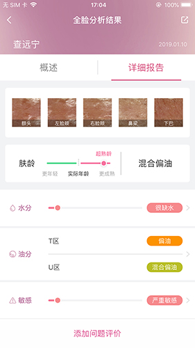 肌肤分析仪app软件截图1